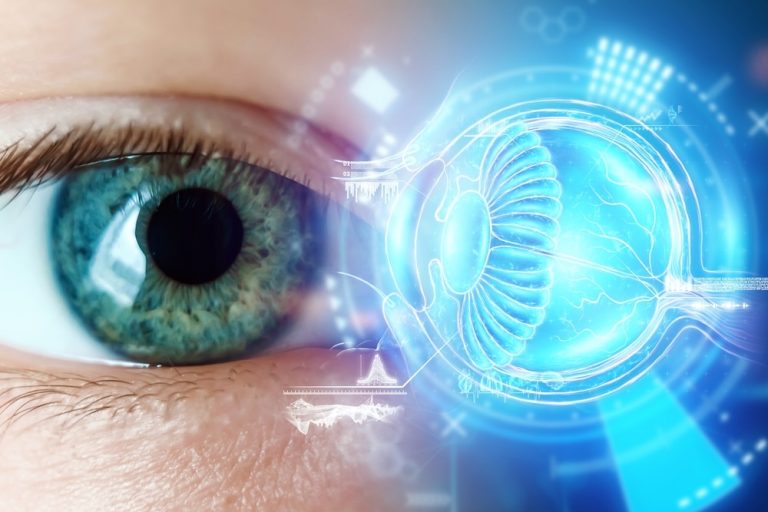 Keratoconus human eye